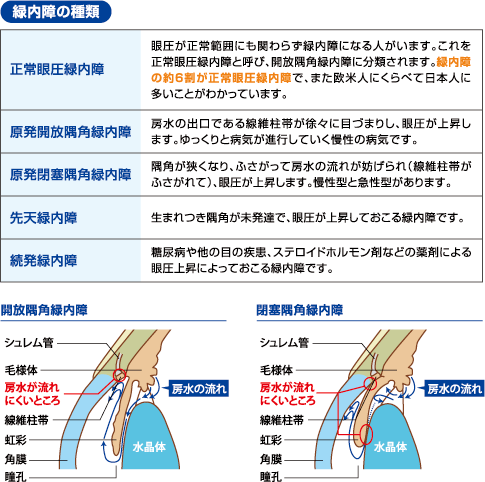 緑内障 池袋東口 徒歩1分の眼科 市橋眼科クリニック